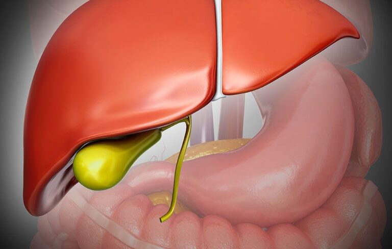 cholecystitis_3_min