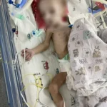 Виснажена двомісячна дитина в реанімаційному ліжку з апаратами